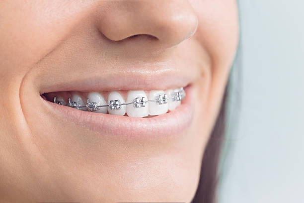 Why Choose Us for Your Dental Needs in Lake Hamilton, FL